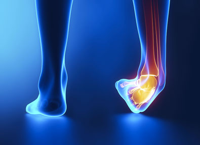 img-entorse-de-la-cheville.jpg
